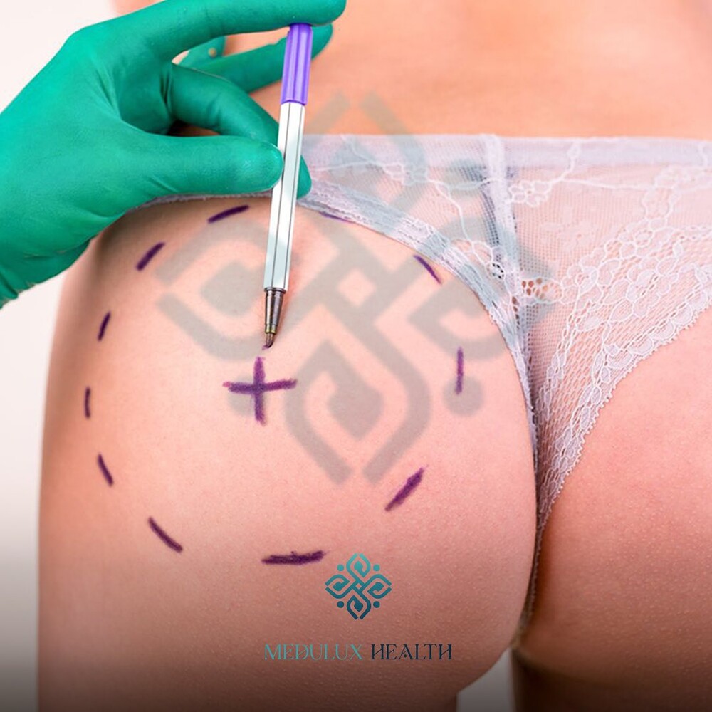 Before and After Result